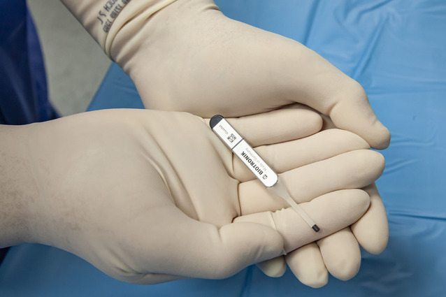 Biomonitor 3 u 22-letniej pacjentki 