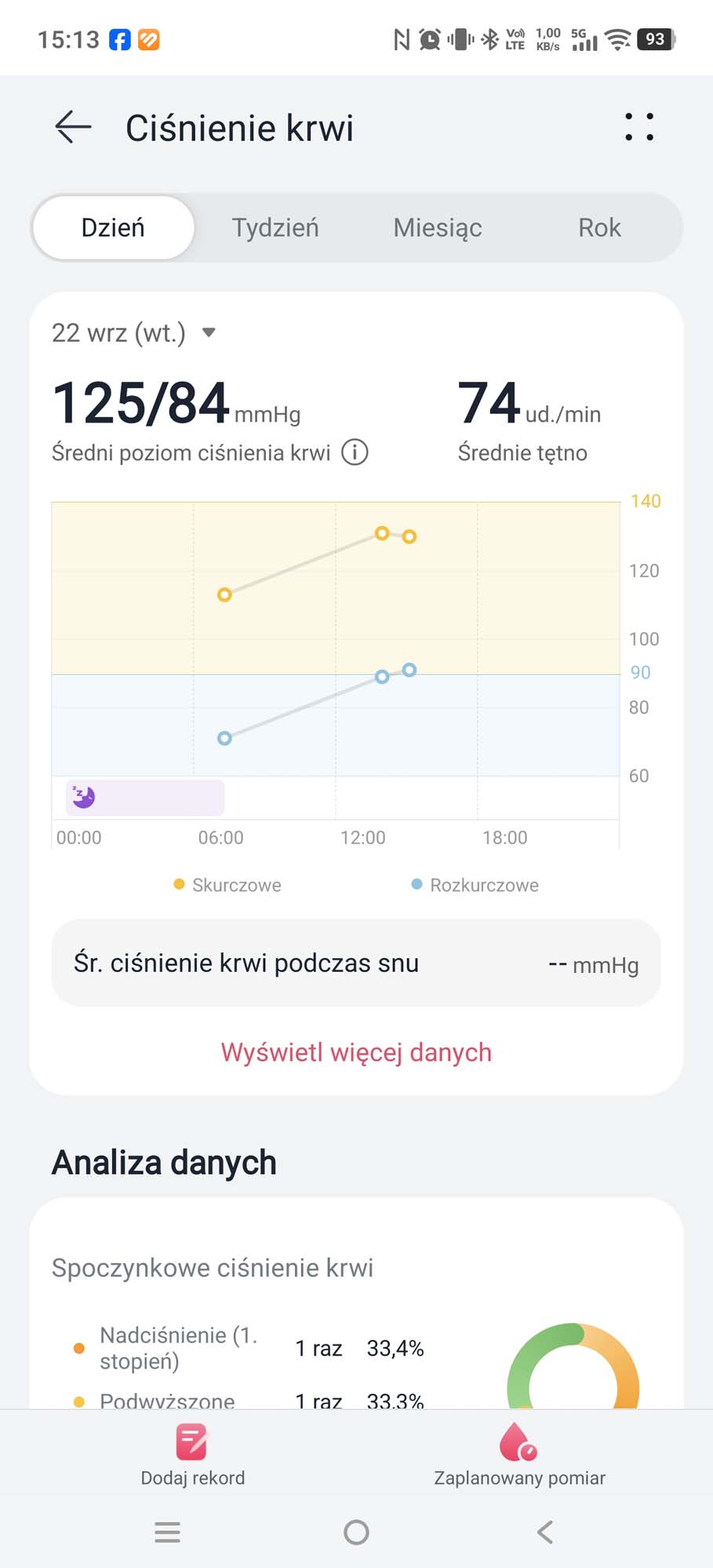 Jak działa zegarek z pomiarem ciśnienia krwi i komu może się przydać?