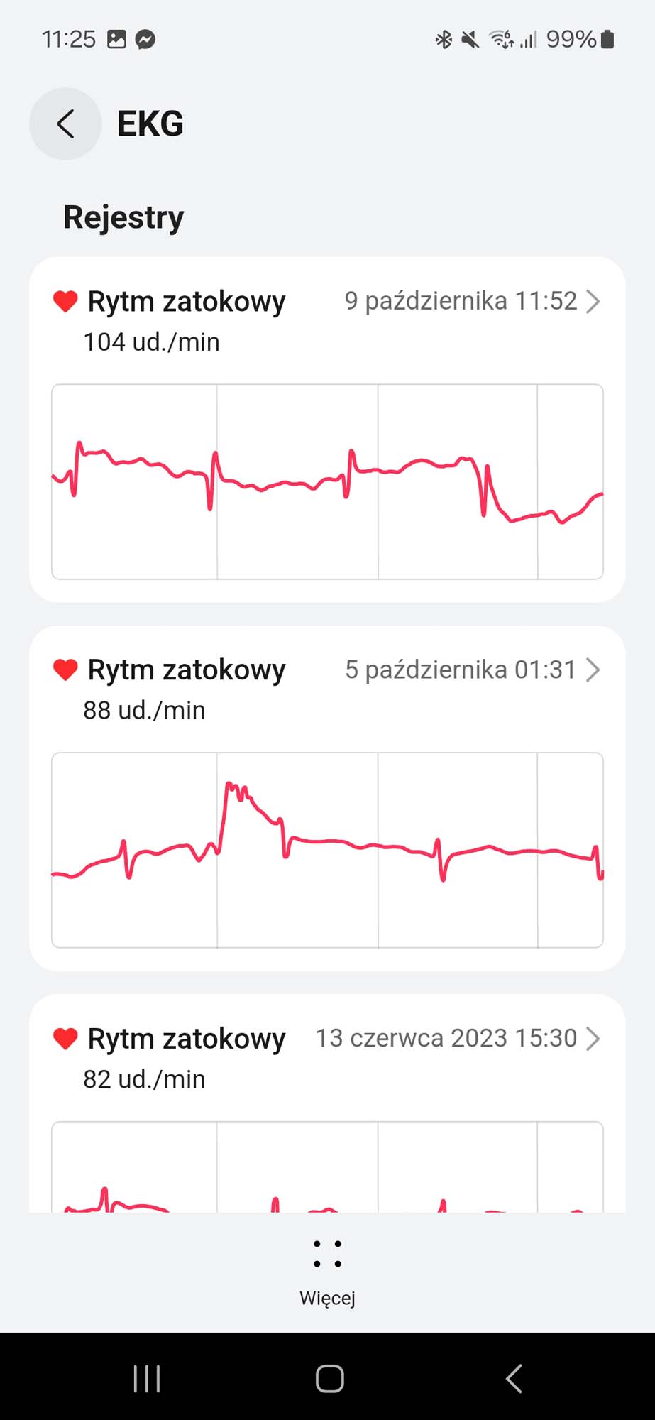 To teraz mój osobisty asystent zdrowia na nadgarstku