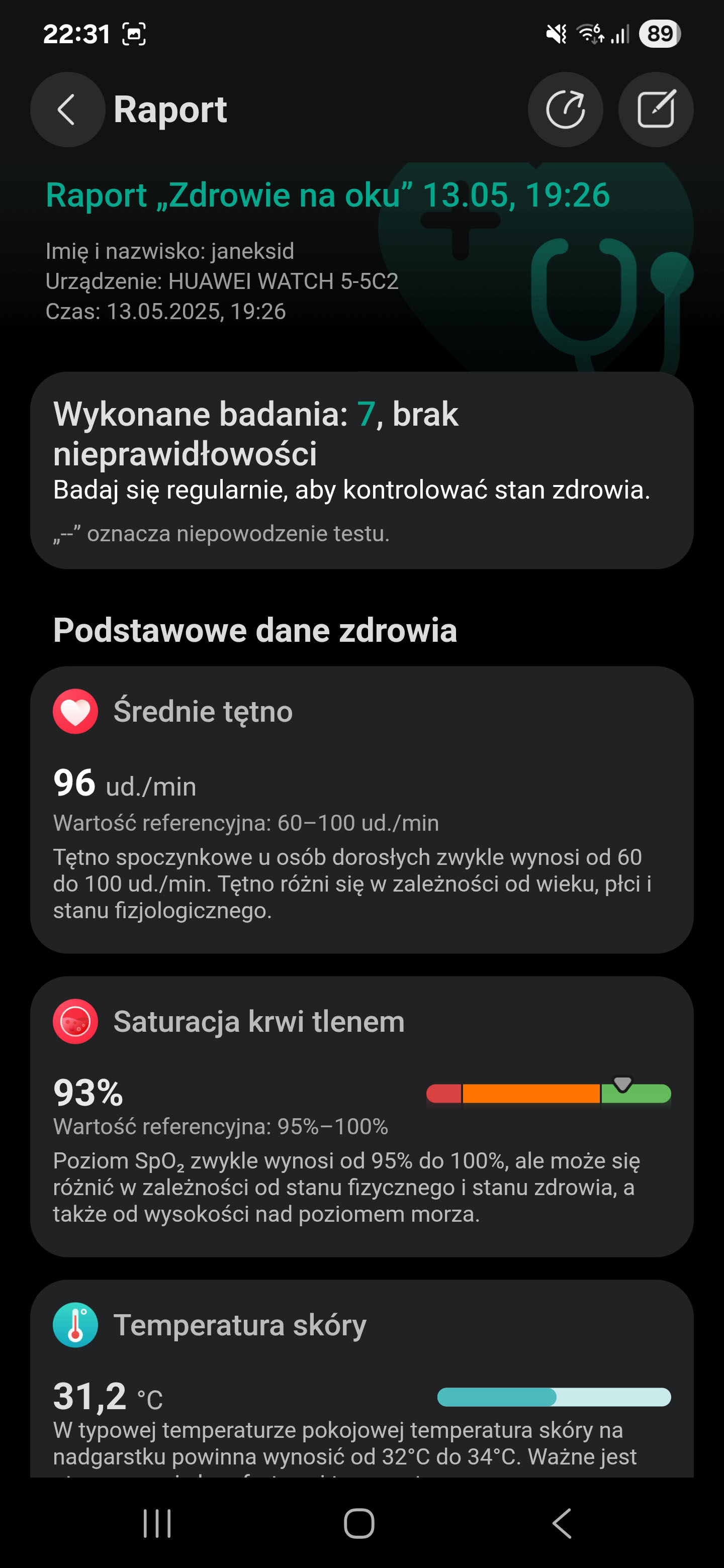 Recenzja Huawei Watch 5 - takiego czujnika nie ma żaden inny smartwatch