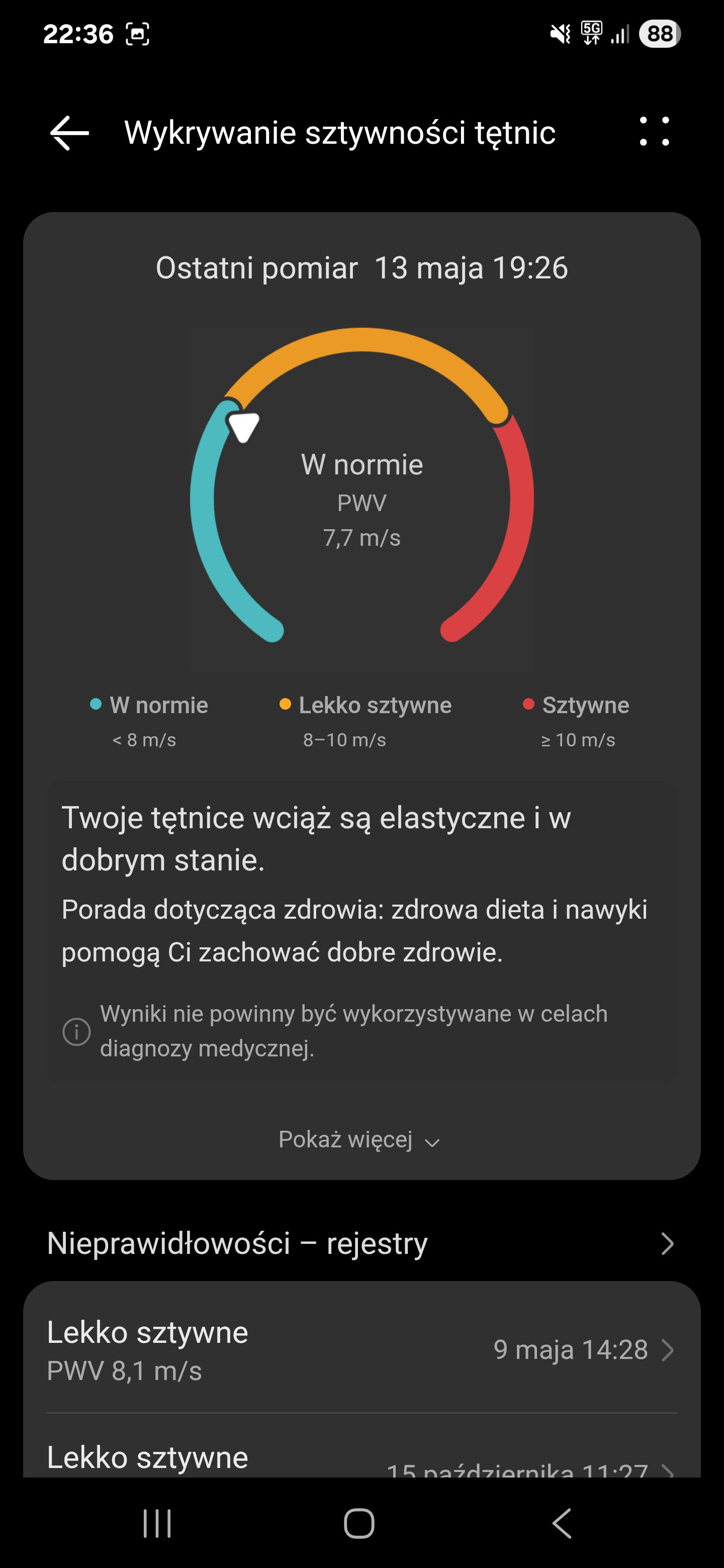 Recenzja Huawei Watch 5 - takiego czujnika nie ma żaden inny smartwatch