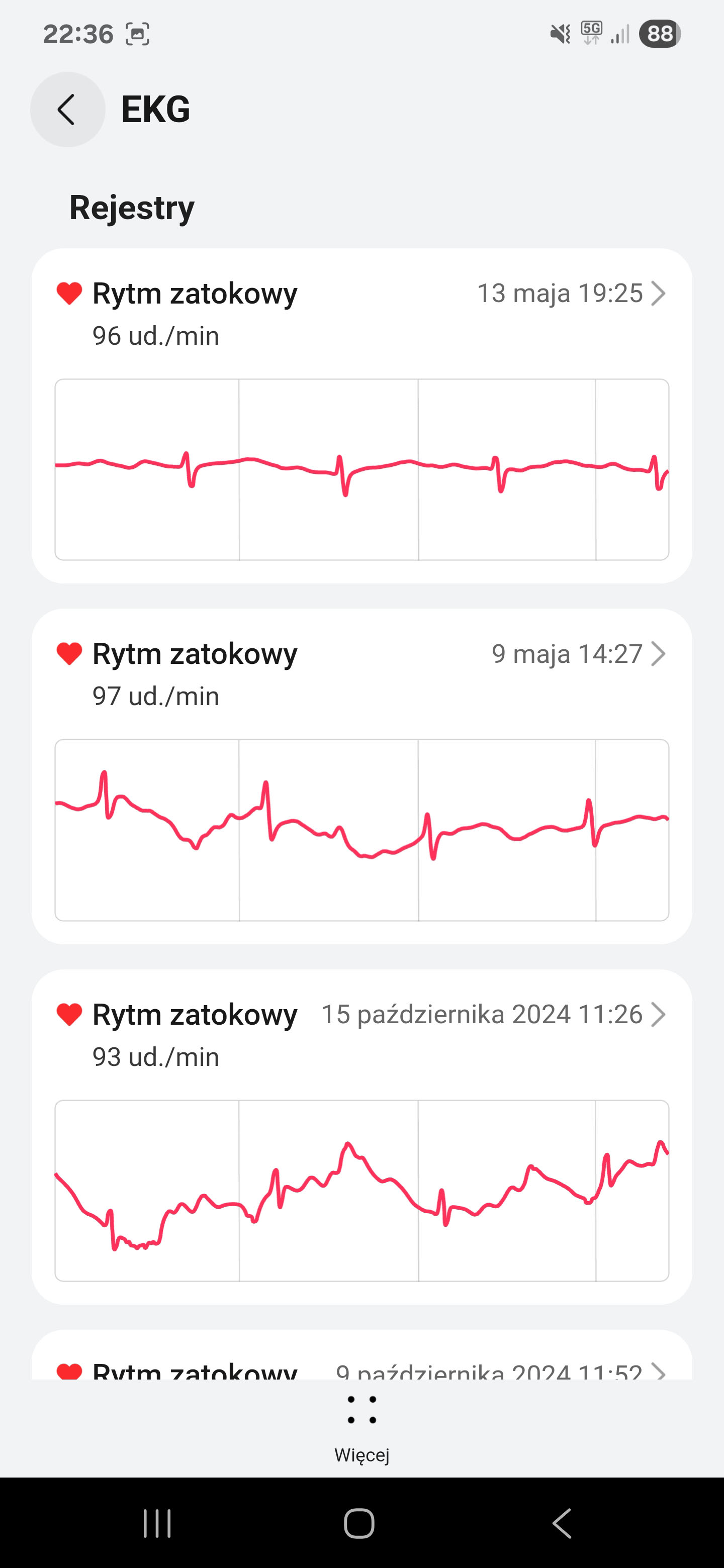 Recenzja Huawei Watch 5 - takiego czujnika nie ma żaden inny smartwatch