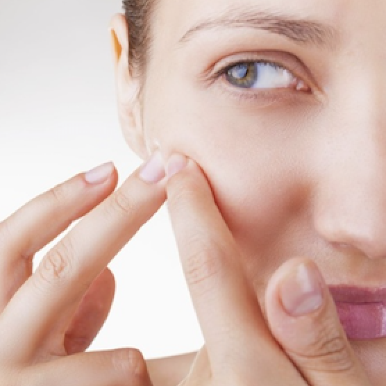 Acne, acne...what can you do ?| Wellness magazine