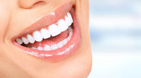 How to whiten your teeth naturally